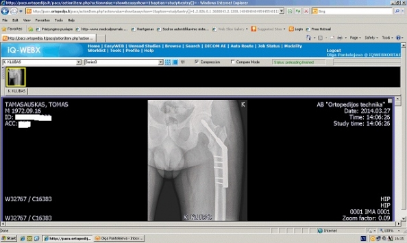x ray